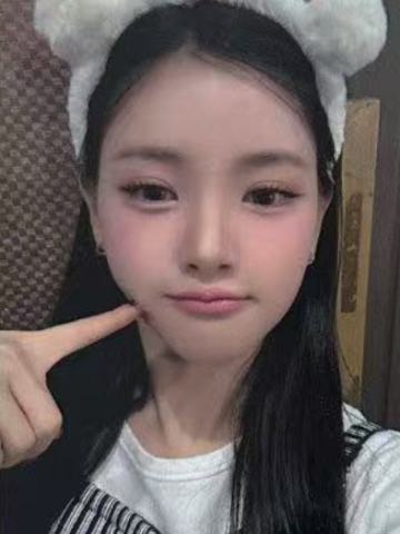 bstage 1 ver.A