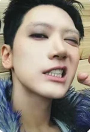 ornament版专卡 疼