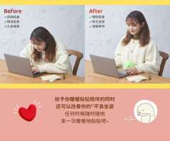 贴贴绿蛇-资料图