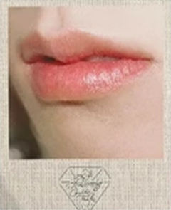 牙医机宝丽来 朱ver.B